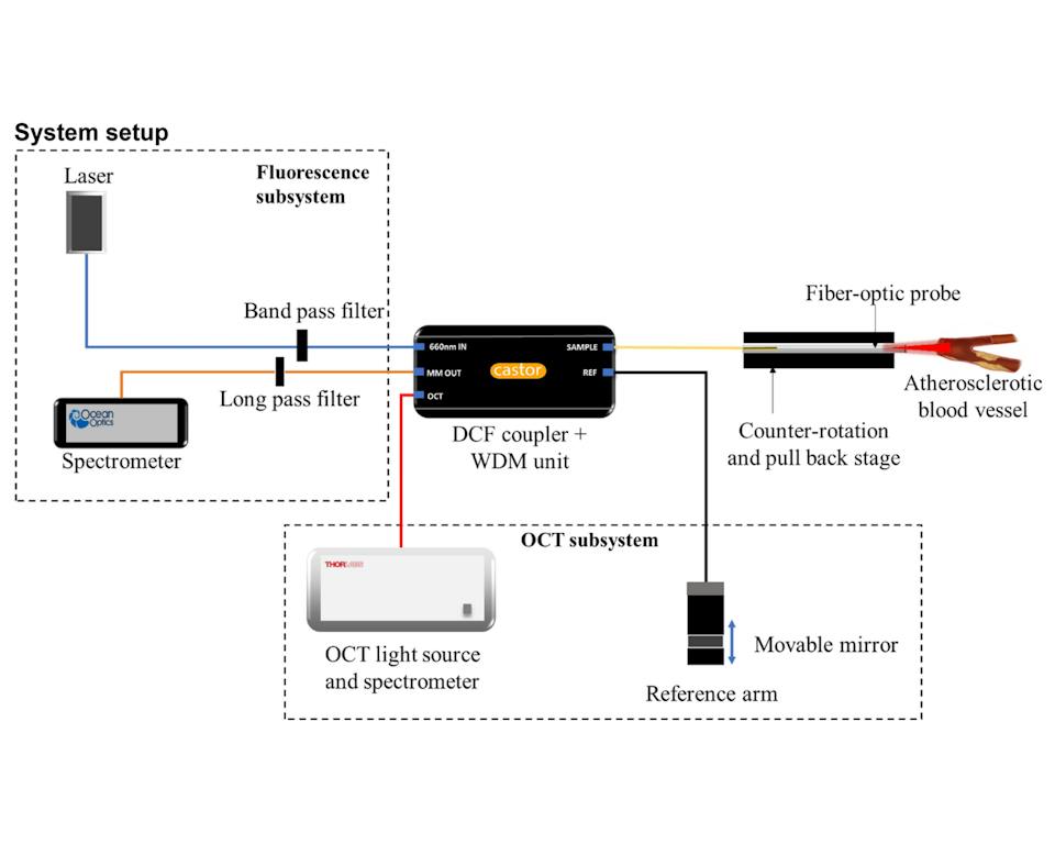 Atherosclerosis plaques unmasked by OCT and fluorescence using a Castor ...